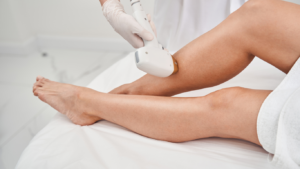 laser hair removal near me