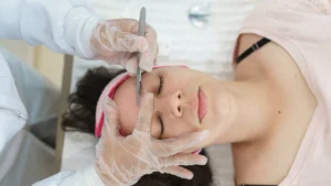 dermaplaning near me