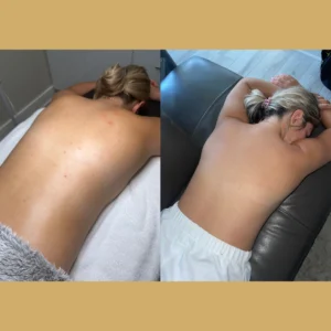 back facial