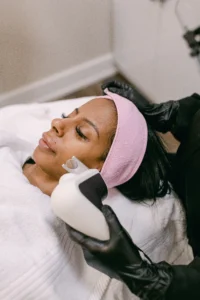 hyperpigmentation laser treatment