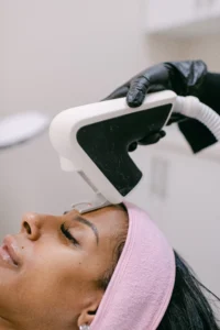 acne laser treatment